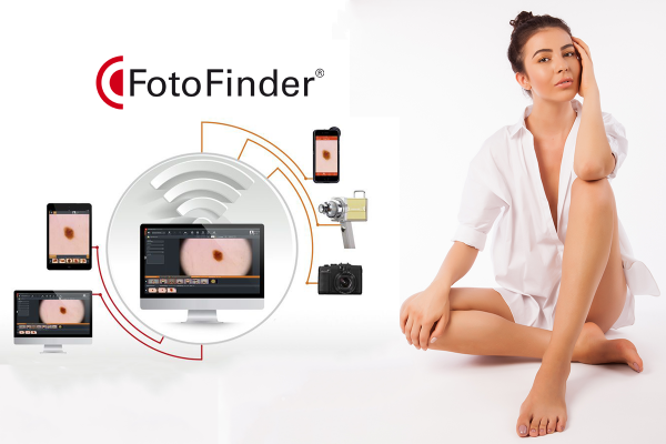 dermatoscopie-digitala-fotofinder